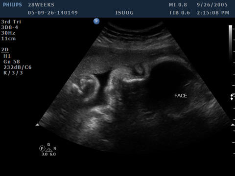 [Image: ultrasound.jpg]